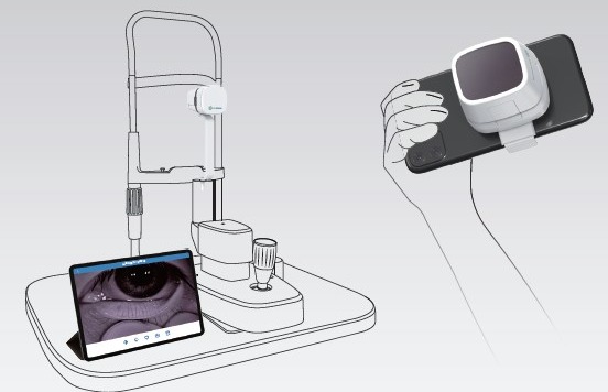 Fotocamera per immagini della ghiandola di Meibomio